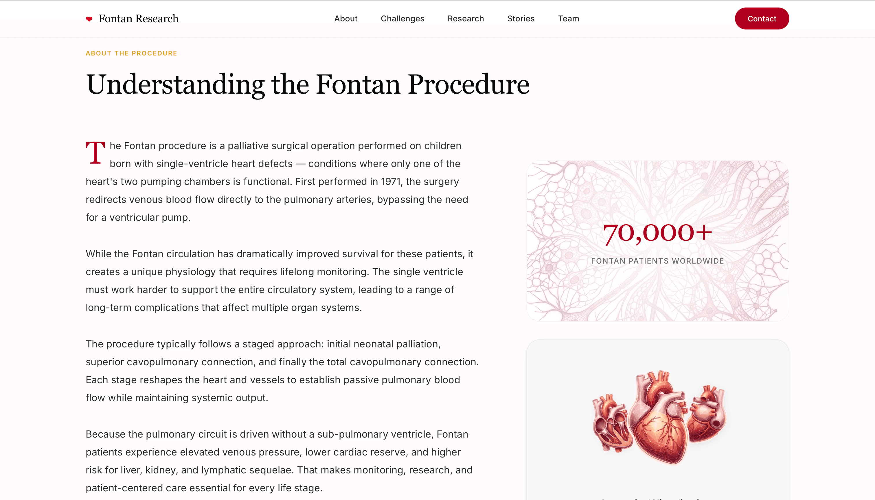 Fontan Research screenshot 2